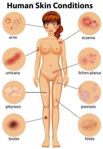 A Human Anatomy of Human Skin Condition vector