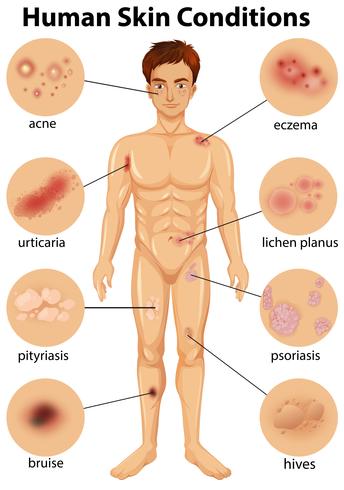 Varias condiciones de la piel humana. vector