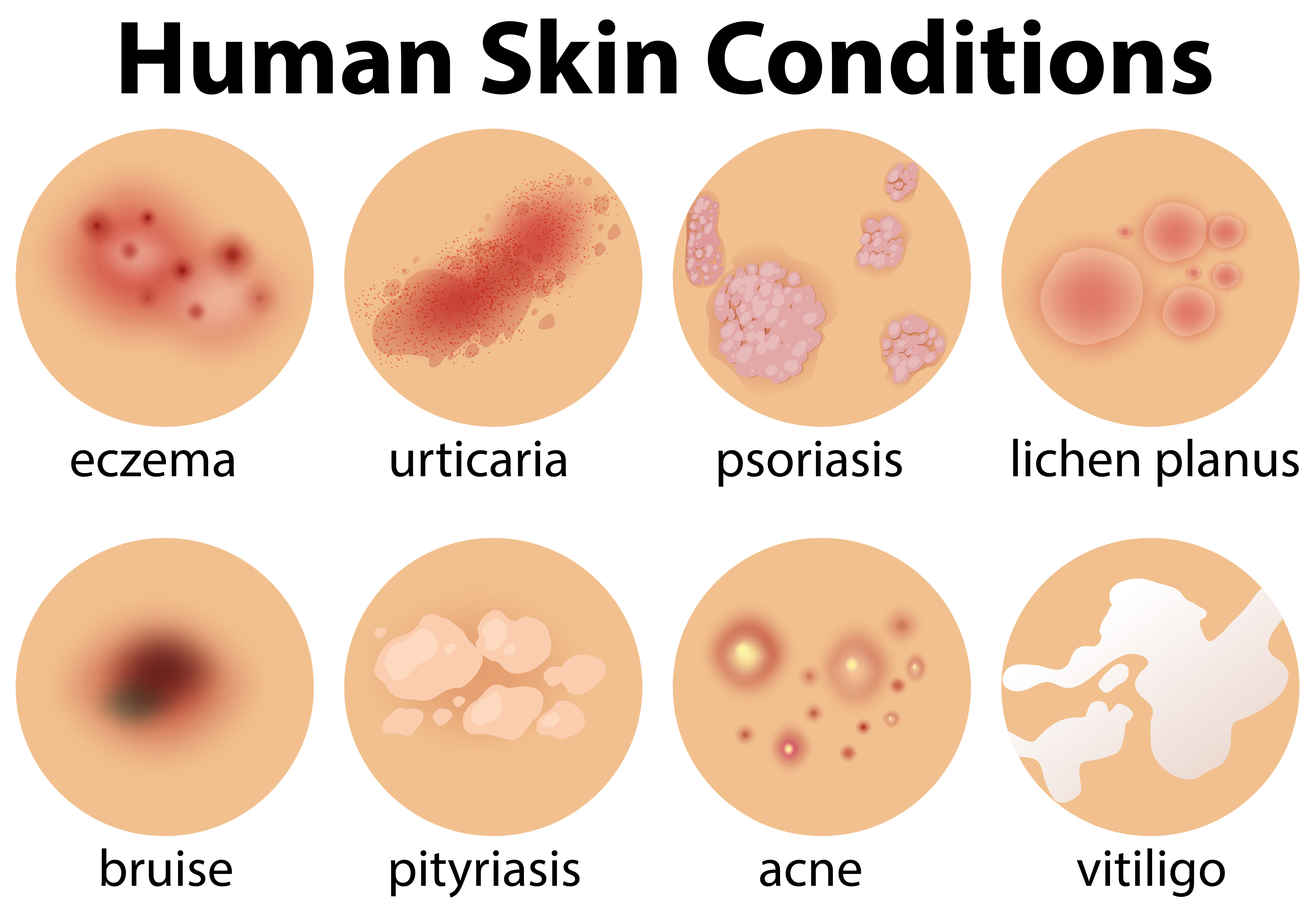 A Set Of Human Skin Conditions 300507 Vector Art At Vecteezy