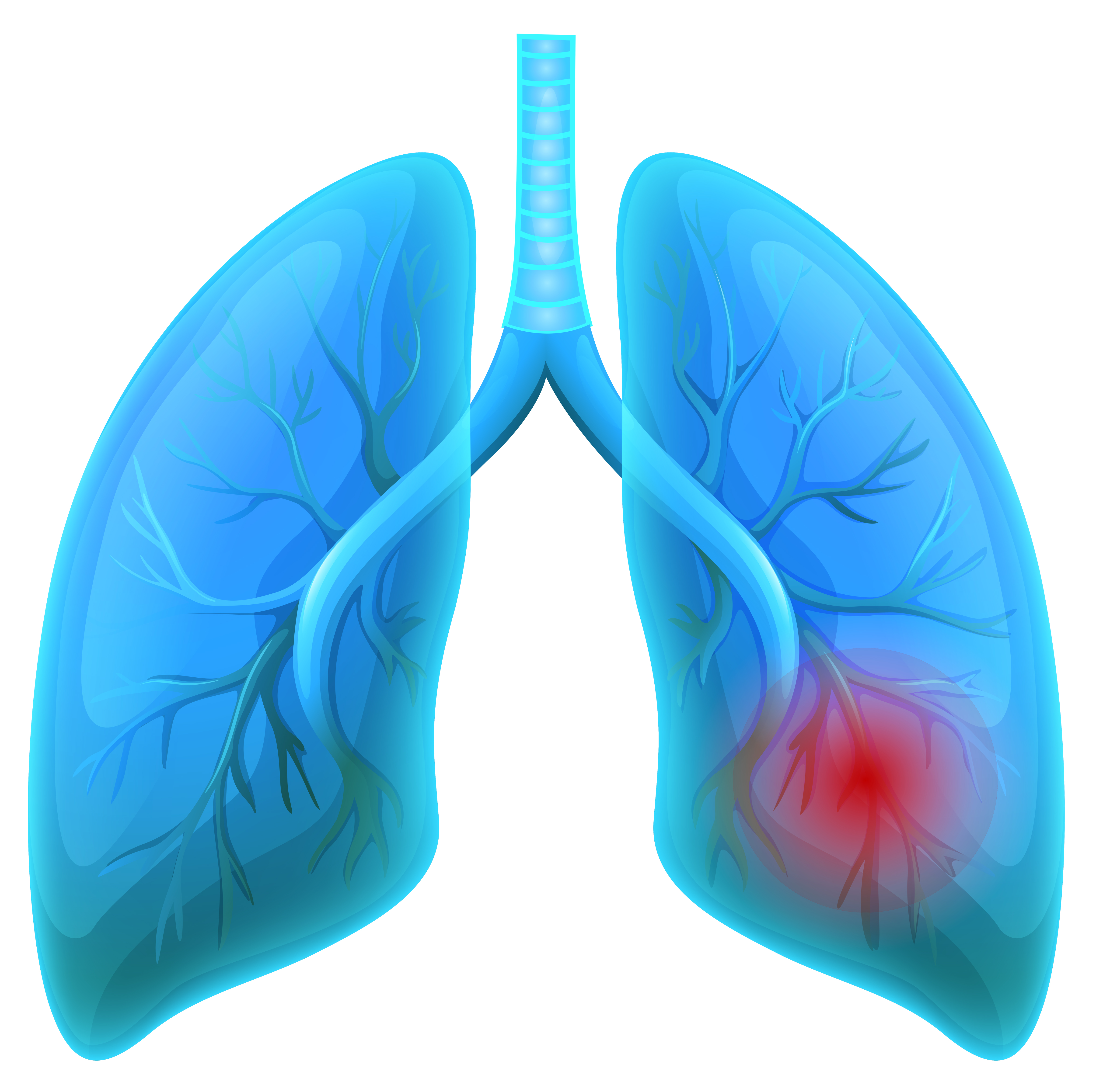 Albums 93+ Pictures Pictures Of Lung Disease Excellent