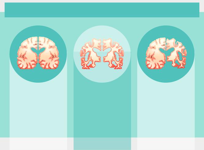 Plantilla de fondo con cerebros humanos vector