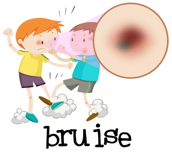 Boys Fighting and Having Bruise vector