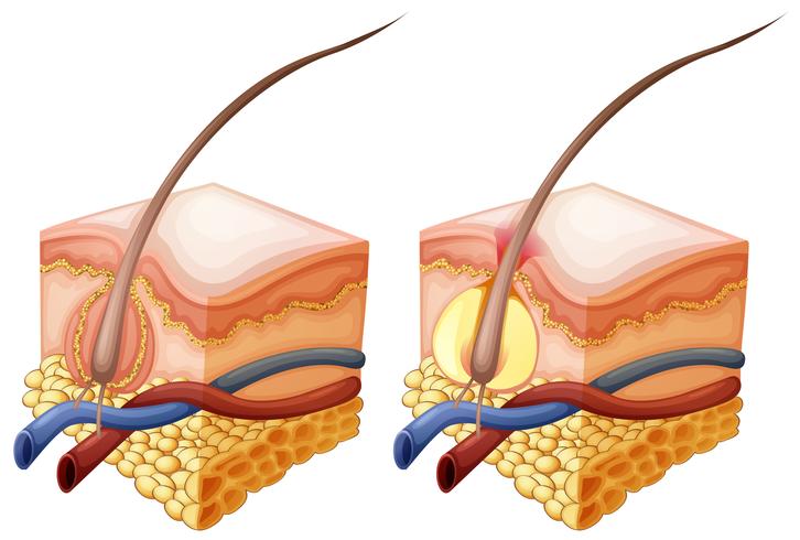 Diagram showing hair and under human skin vector