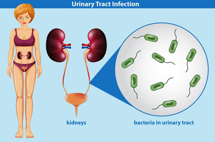 Human Anatomy of Urinary Tract Infection vector