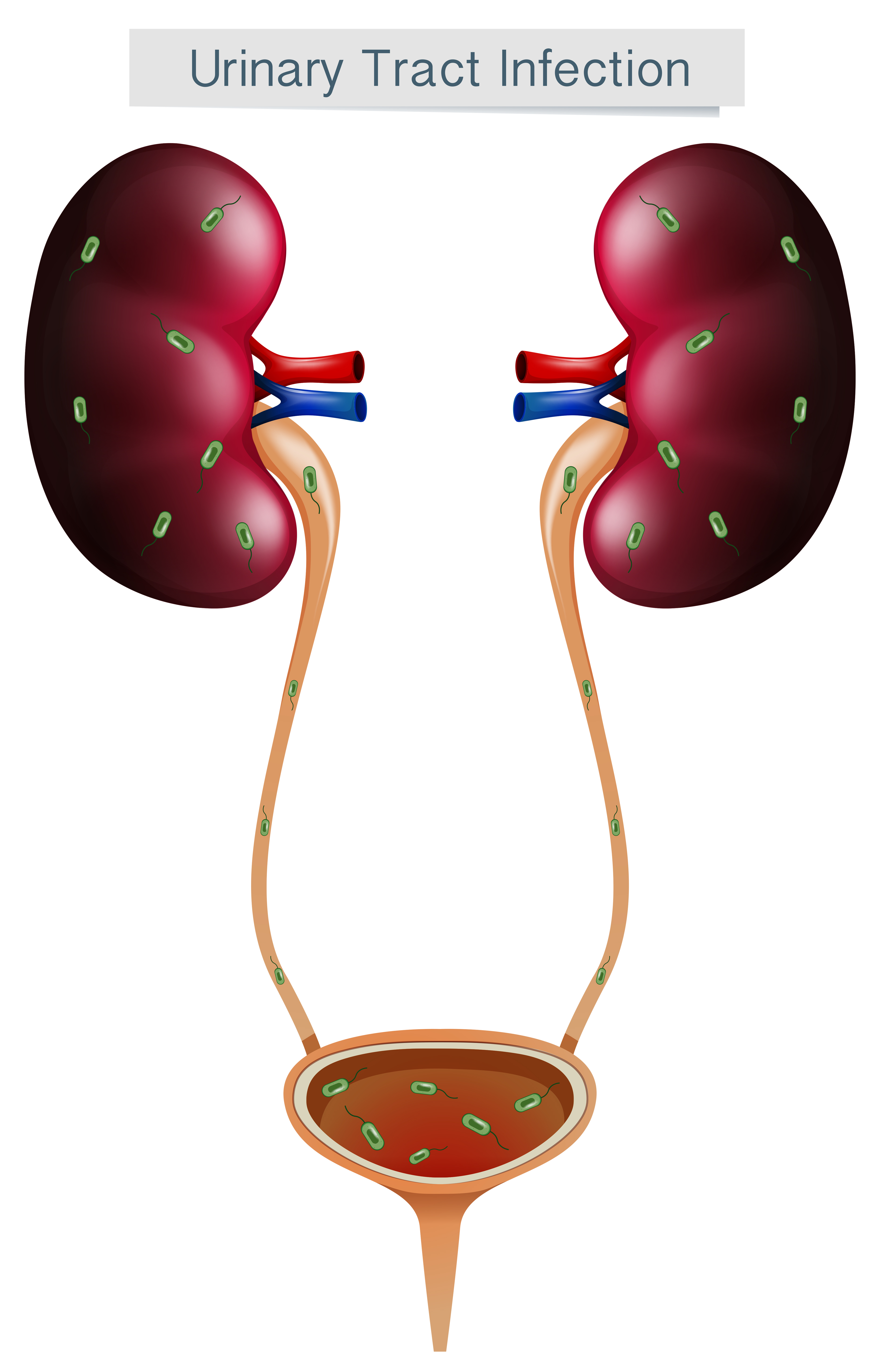 Urinary Tract