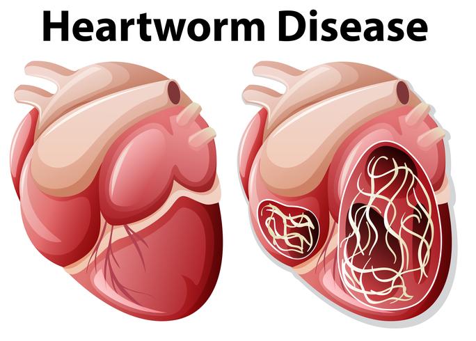 Diagrama de la enfermedad del gusano del corazón fondo blanco vector