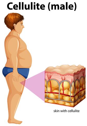 Un hombre gordo con celulitis. vector