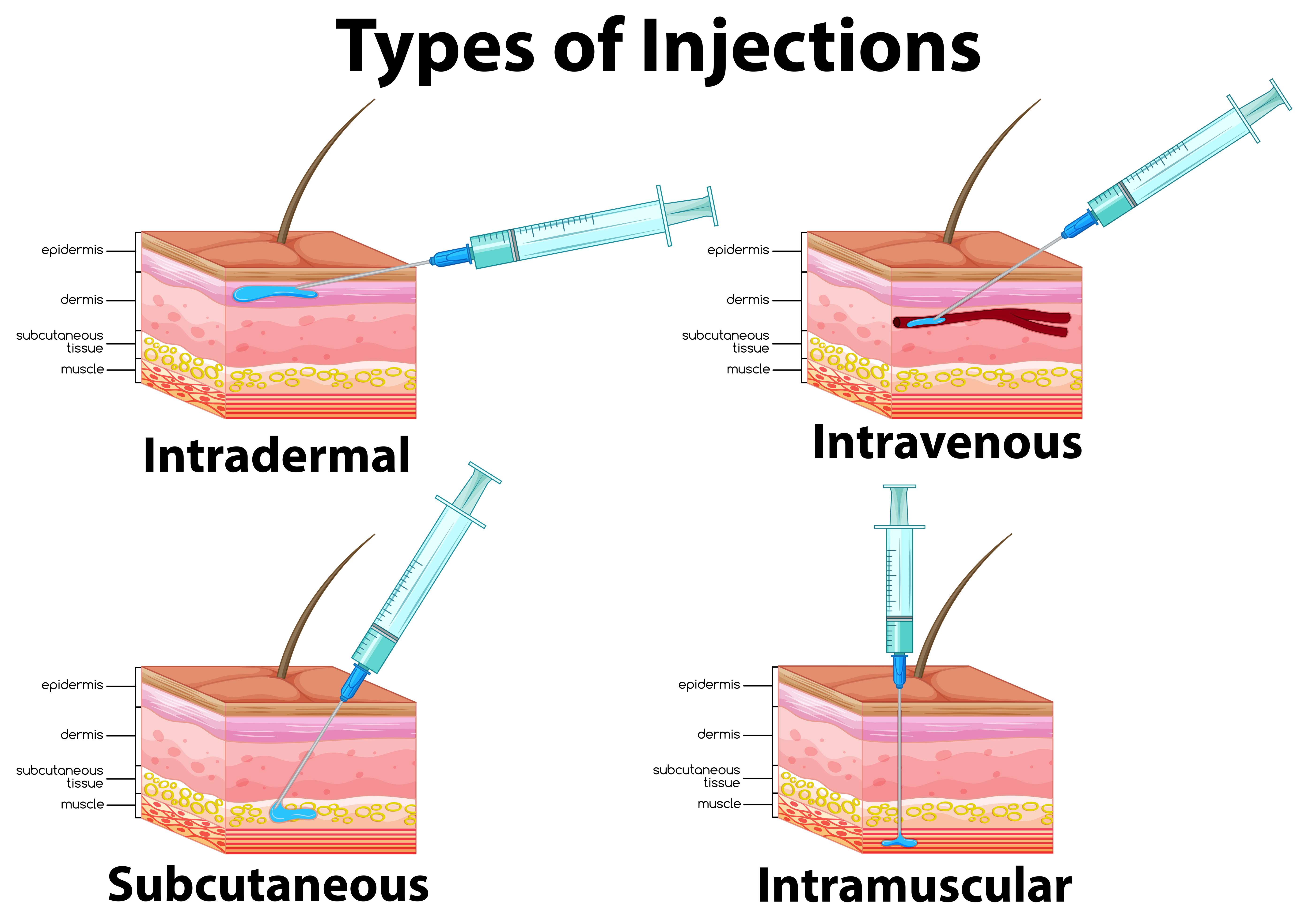 A Set of Type of Injections 358965 - Download Free Vectors, Clipart
