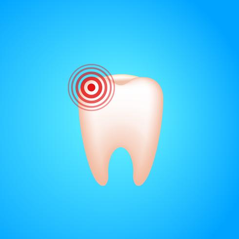 Dolor de muelas. Un diente con caries dental y dolor. Vector realista ilustración