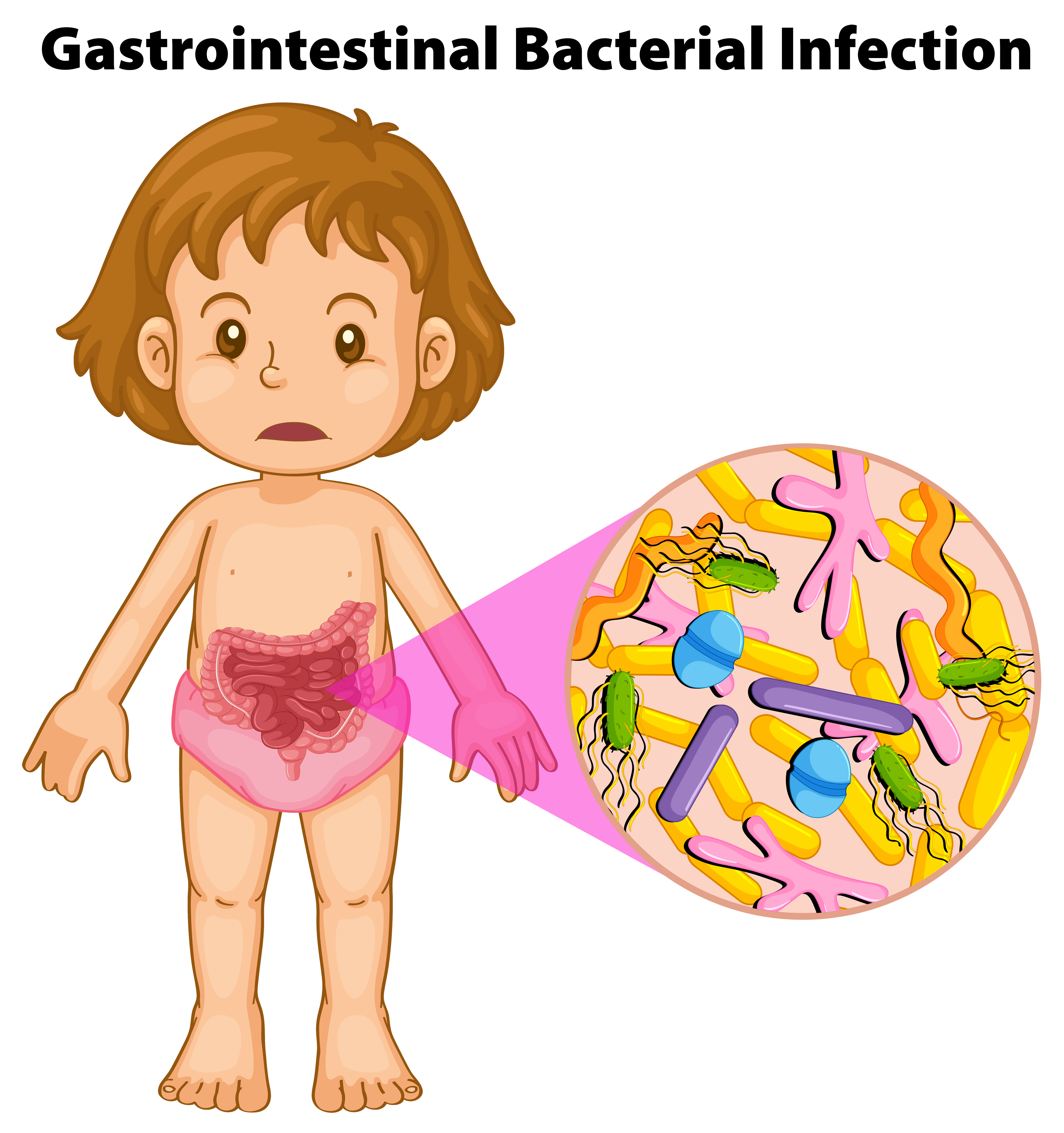human-girl-and-gastrointestinal-bacterial-infection-359607-vector-art