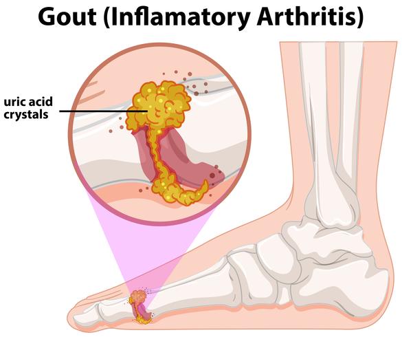 Una gota de anatomía humana médica vector