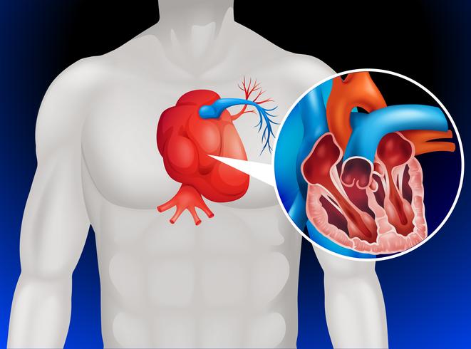 Heart disease diagram in detail vector