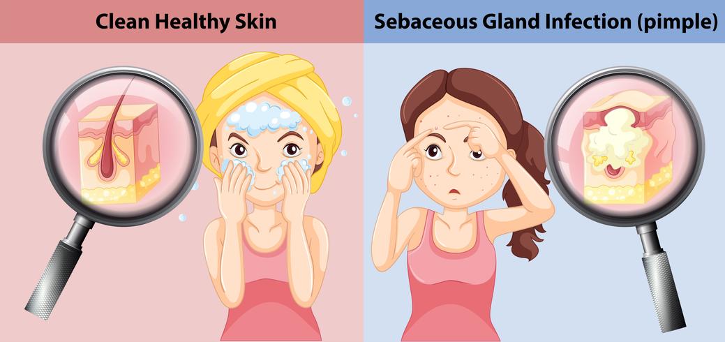 A Comparison of Skin Condition vector