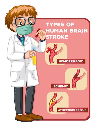 Doctor and diagram showing human brain strokes