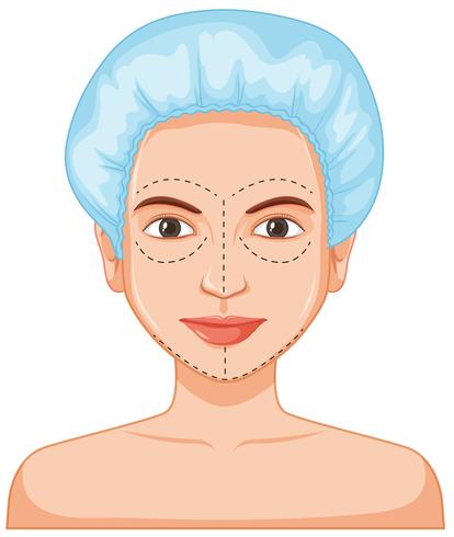 Lady facial skin botox vector