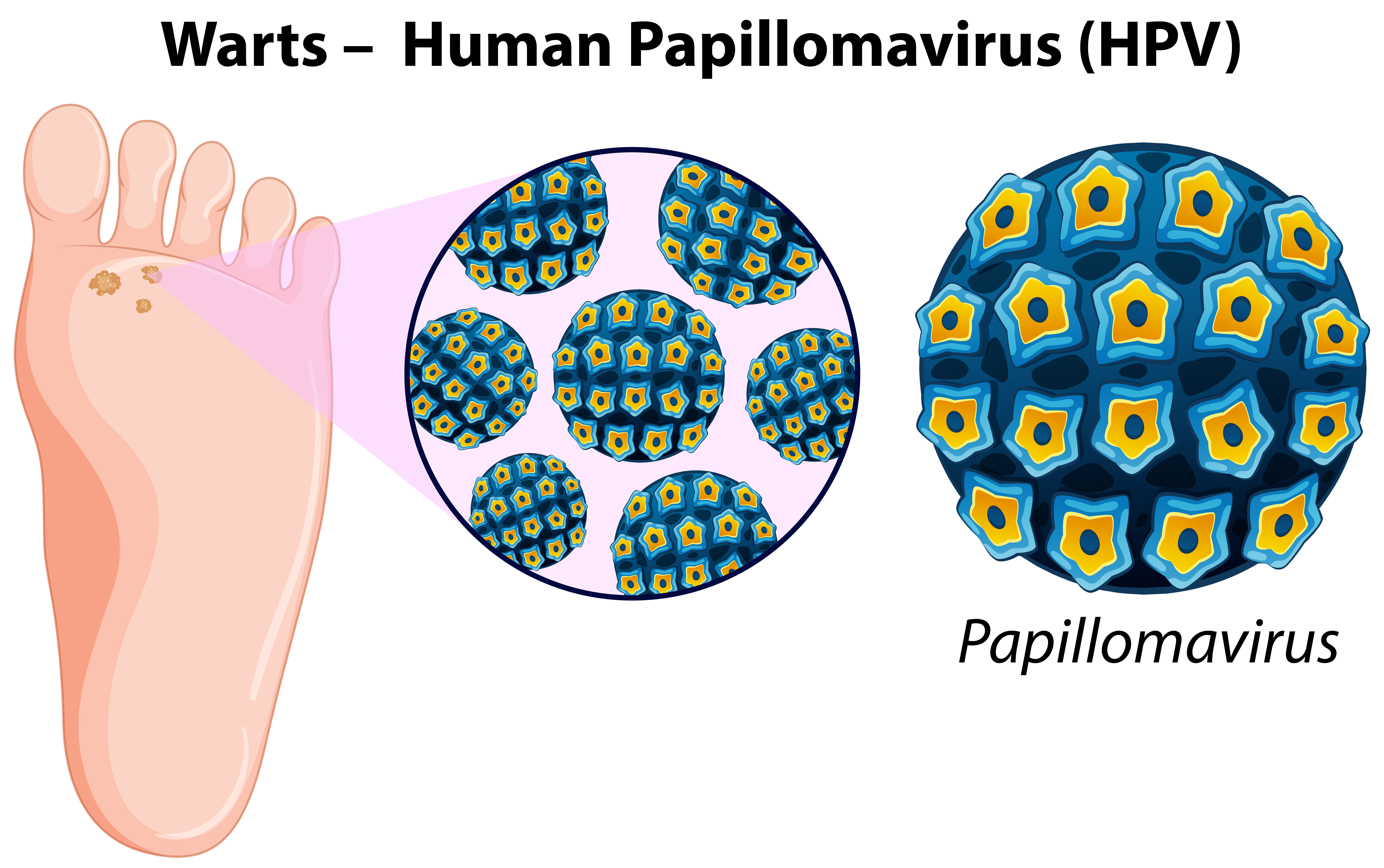Папиломы вирус передается от человека к человеку. Папилломавируса человека. Папилломавирус рисунок.