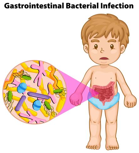 Infección bacteriana gastrointestinal y del niño. vector