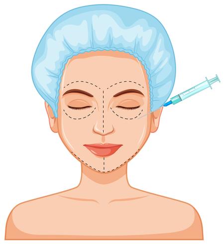 Inyección de piel de relleno de botox facial vector