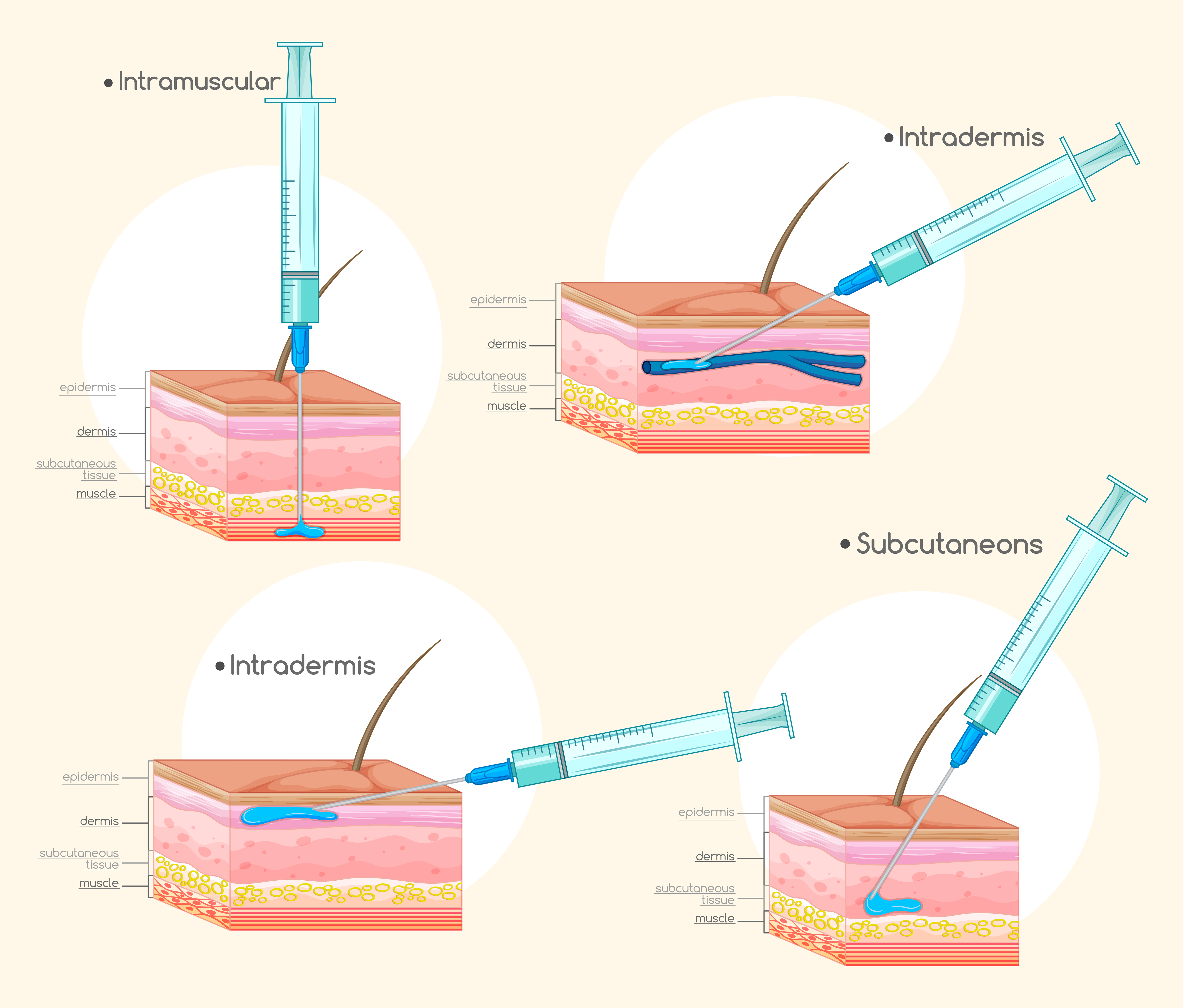 Different types of injections 417375 Vector Art at Vecteezy