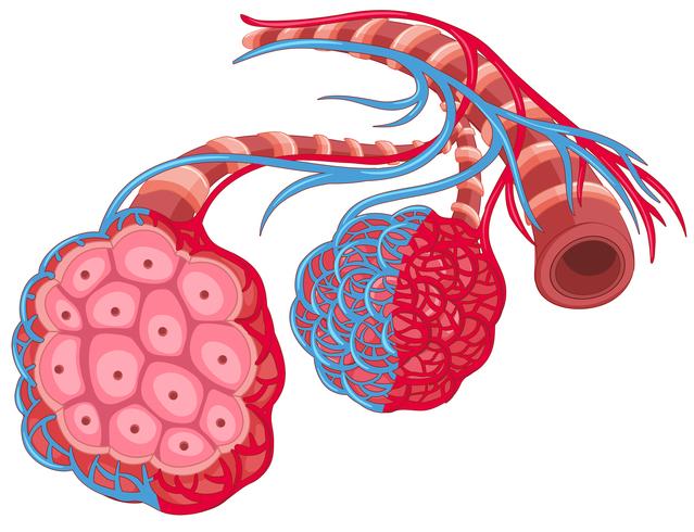 Pulmón humano con enfermedad vector