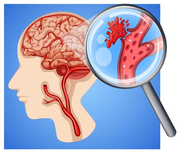 Human with small vessel strokes vector