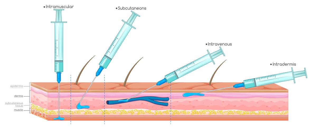 Diagram showing injection with syringe vector