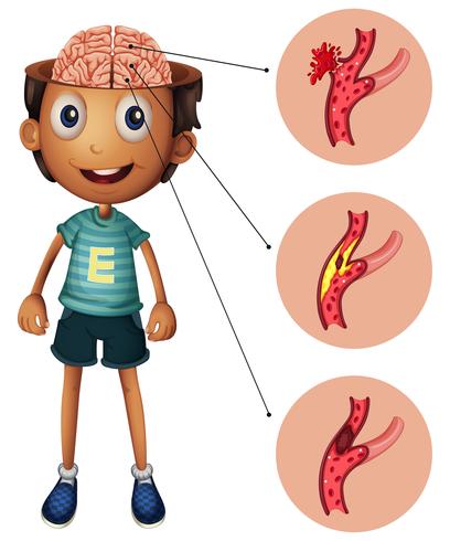 Boy and brain with strokes vector