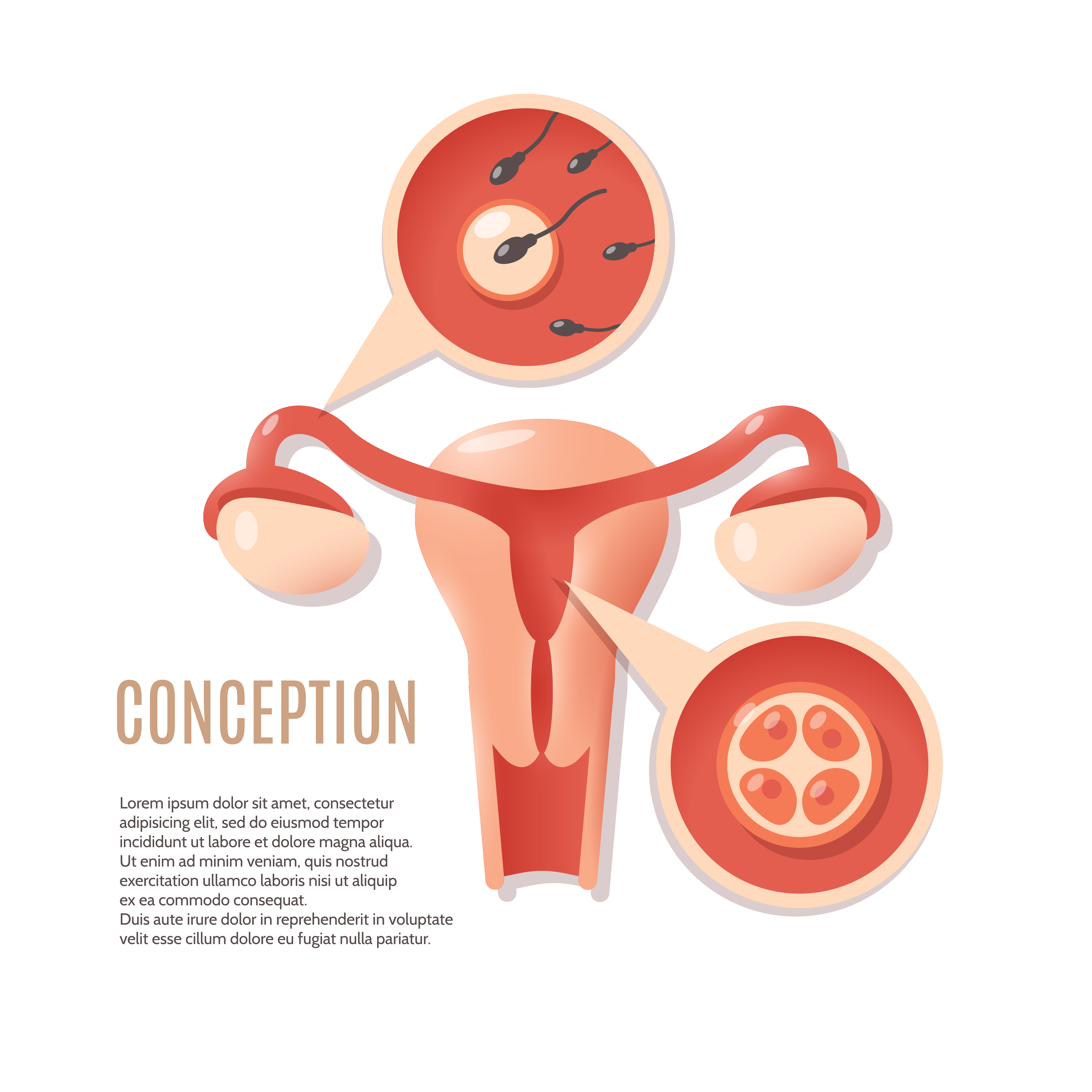 Conception Conception