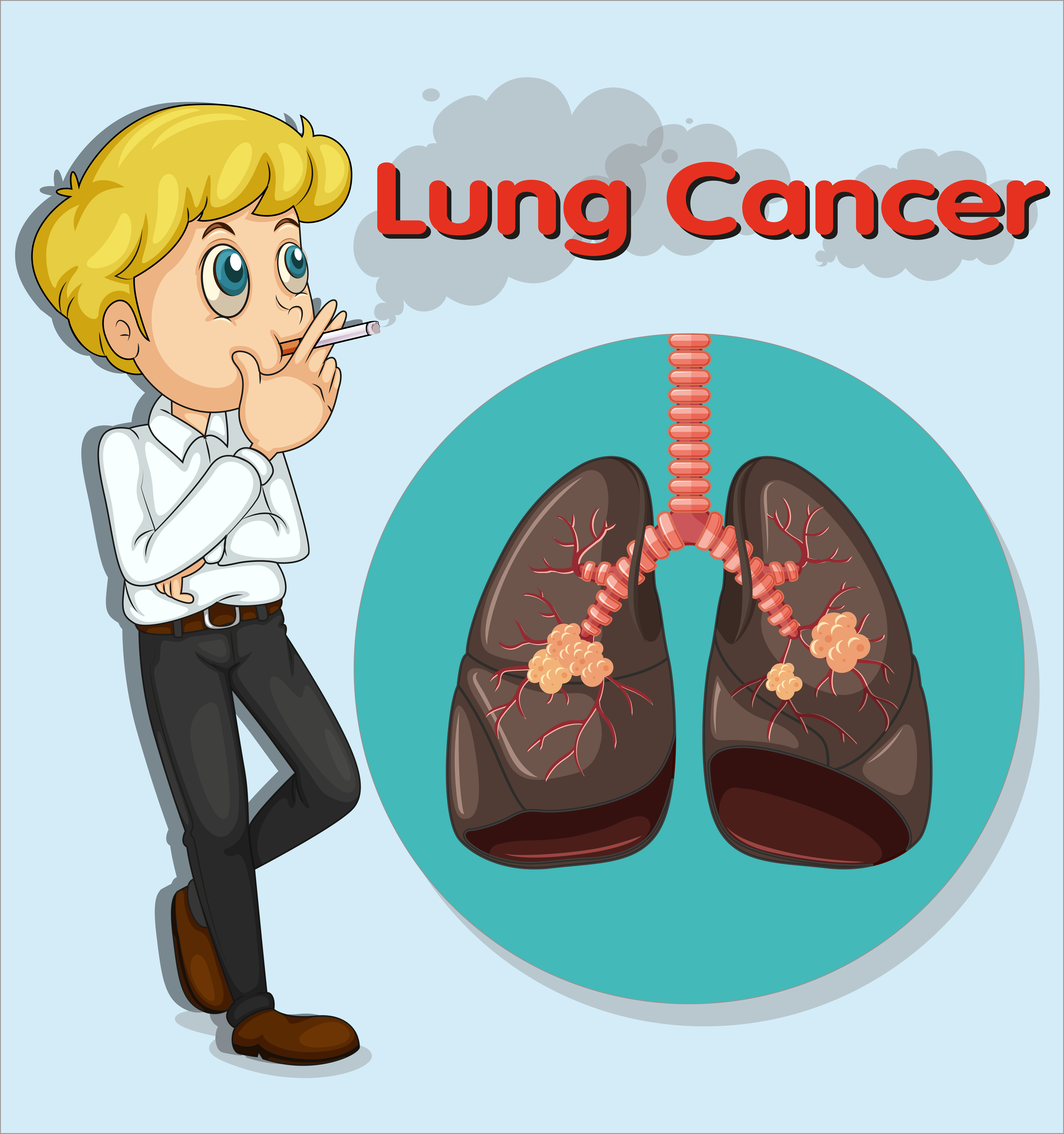 Man smoking and lung cancer 431848 Vector Art at Vecteezy