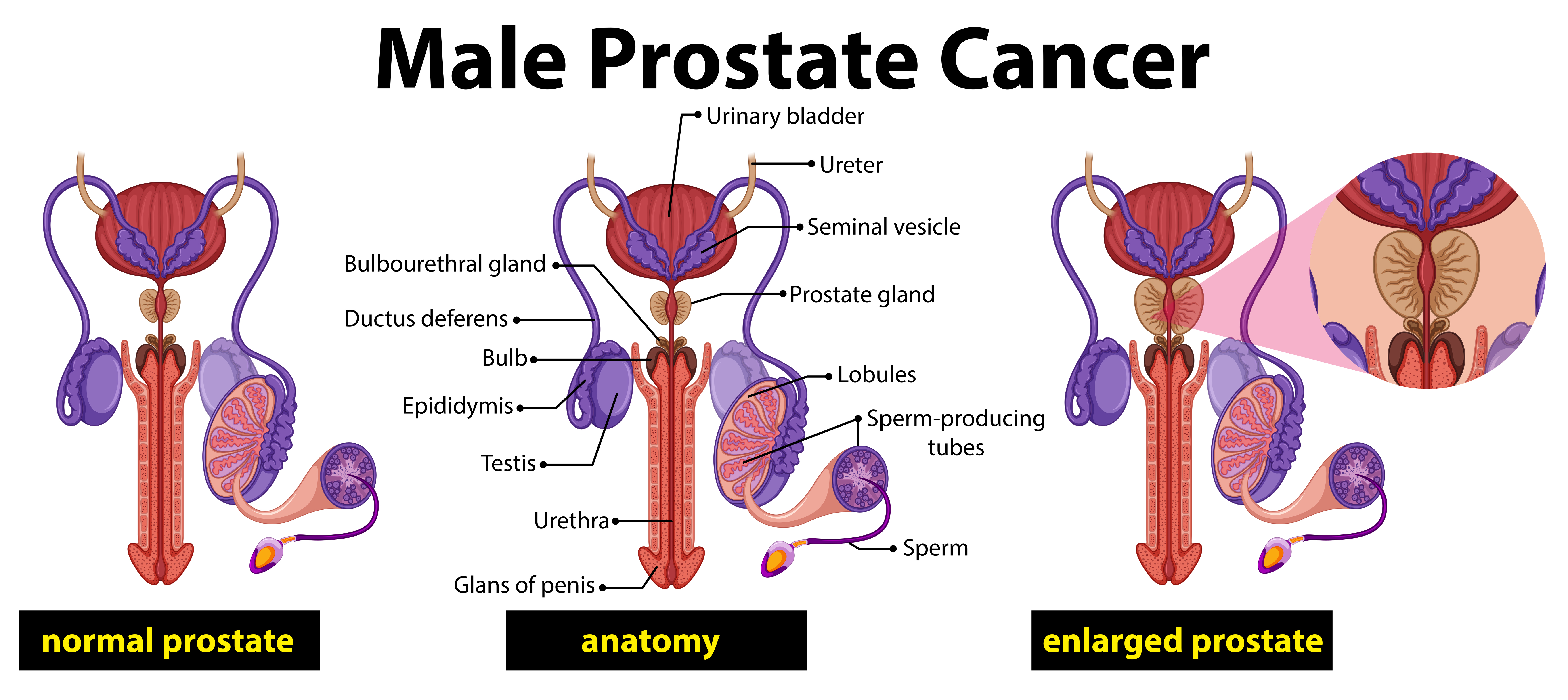 prostate gland diagram