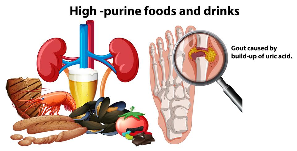 Alimentos y bebidas con alto contenido de purina vector