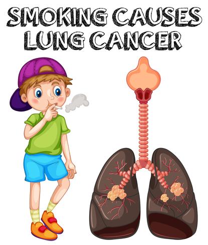 Boy smoking cigarette and lung cancer vector