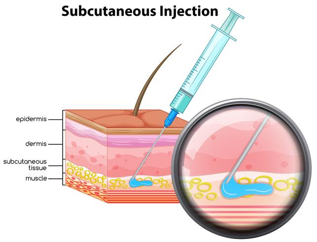 Skin subcutaneous Injection diagram vector