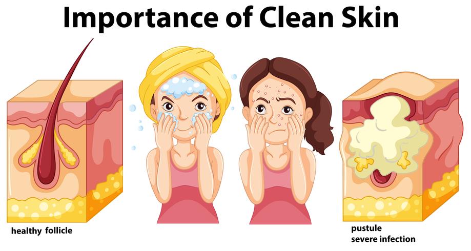 Importance of clean skin concept vector