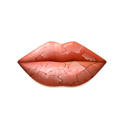 Ilustración de labios secos vector
