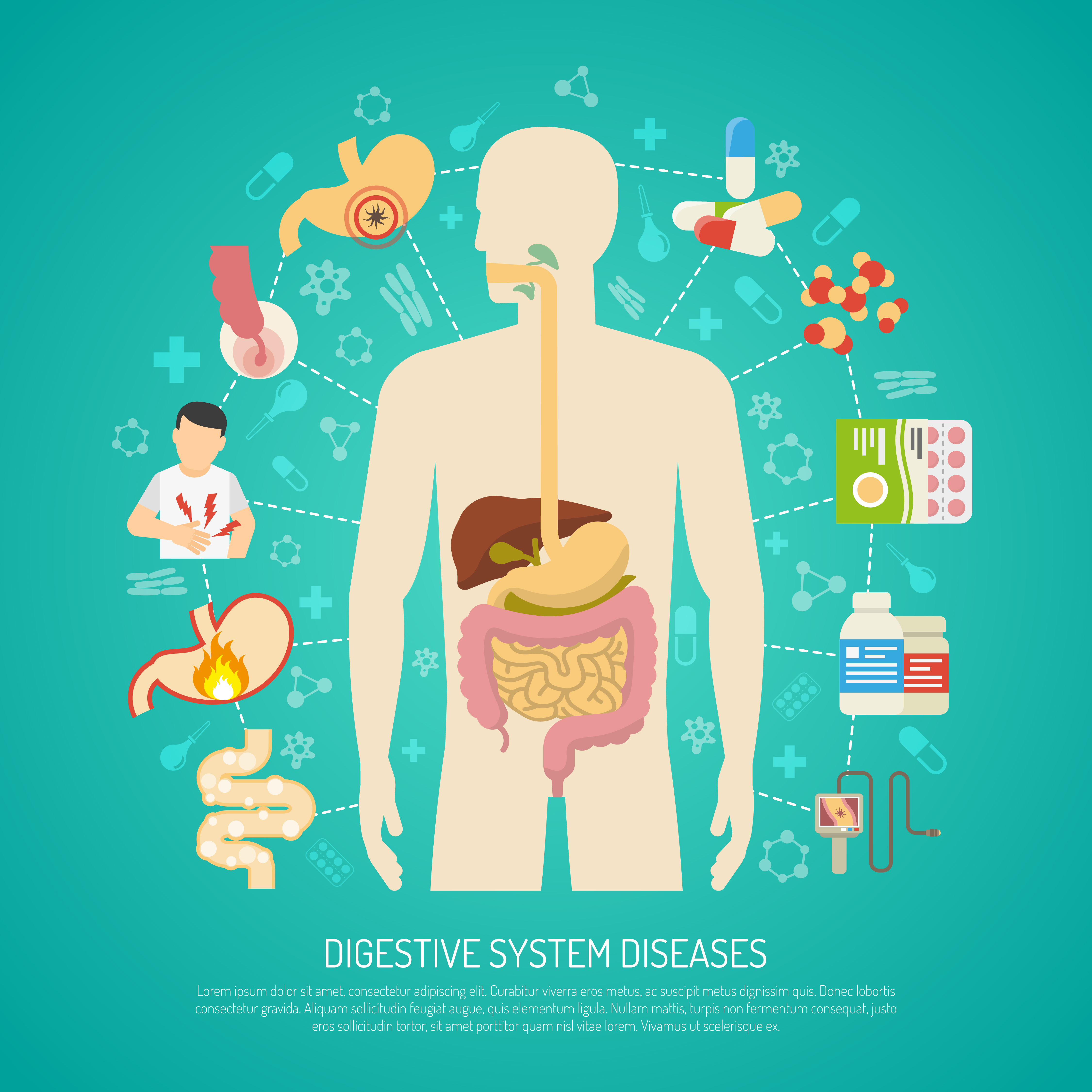 Digestive System Diseases Illustration - Download Free Vectors, Clipart