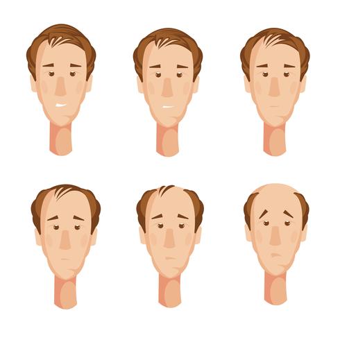 Balding Man Heads Set vector