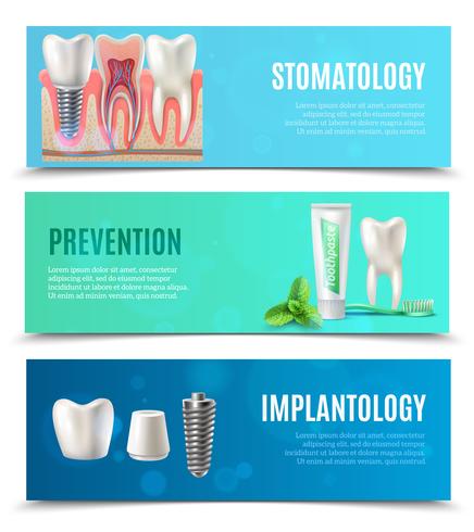 Dental Implants 3 Horizontal Banners Set vector