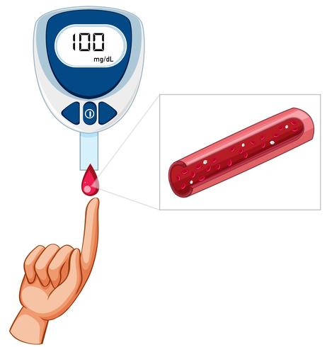 Prueba médica de glucosa en sangre vector