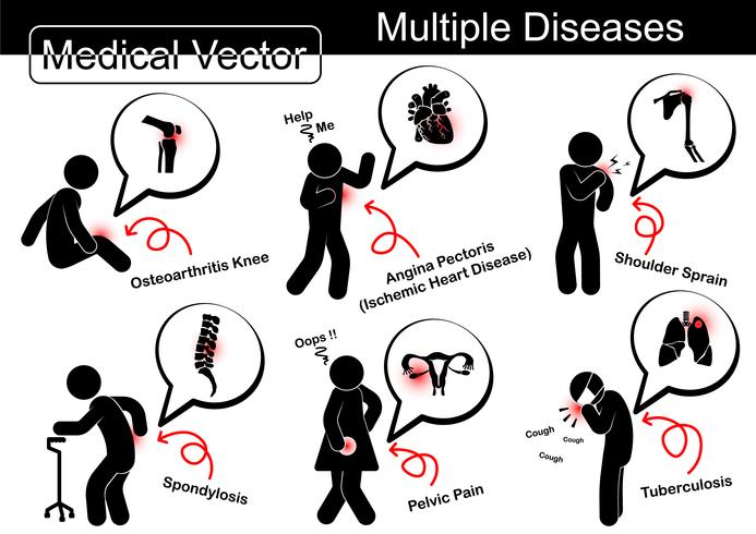 Multiple diseases  Osteoarthritis knee , Ischemic heart disease , Shoulder sprain , Spondylosis , Pelvic pain , Pulmonary tuberculosis  TB   vector