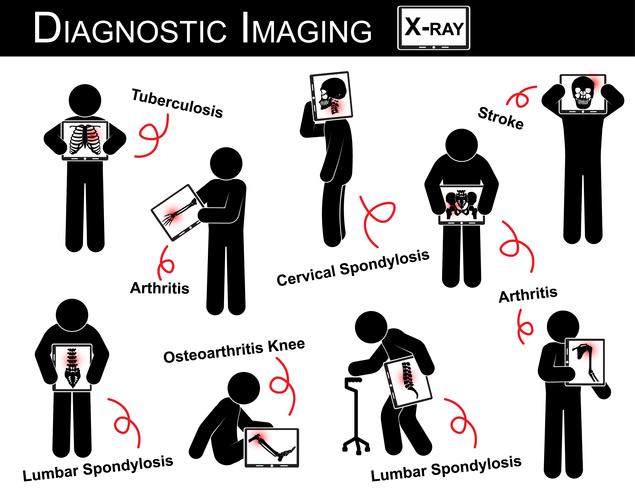Diagnostic Imaging & Multiple Disease stick man vector ( Pulmonary Tuberculosis , Arthritis , Cervical Spondylosis , Lumbar Spondylosis & Spondylolisthesis , Scoliosis , Osteoarthritis Knee , Stroke )