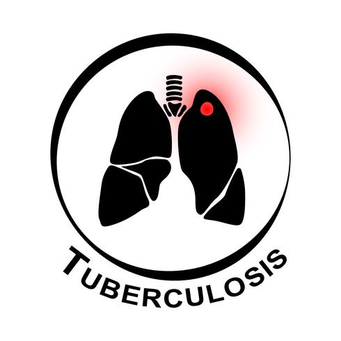 Símbolo de la tuberculosis pulmonar. Pulmón con cavidad en el lóbulo superior izquierdo debido a la infección por Mycobacterium tuberculosis. vector