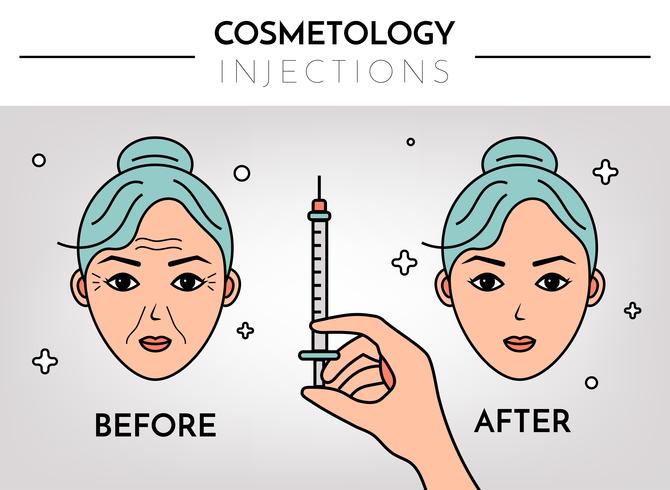 Cosmetic injections. Infographics before and after. Vector flat illustration with place for text. Mesotherapy, rejuvenation.