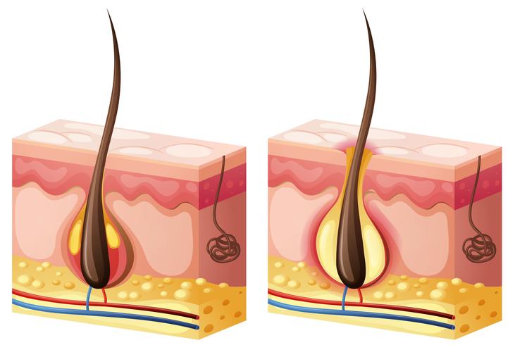 Diagram showing hair growing from skin vector