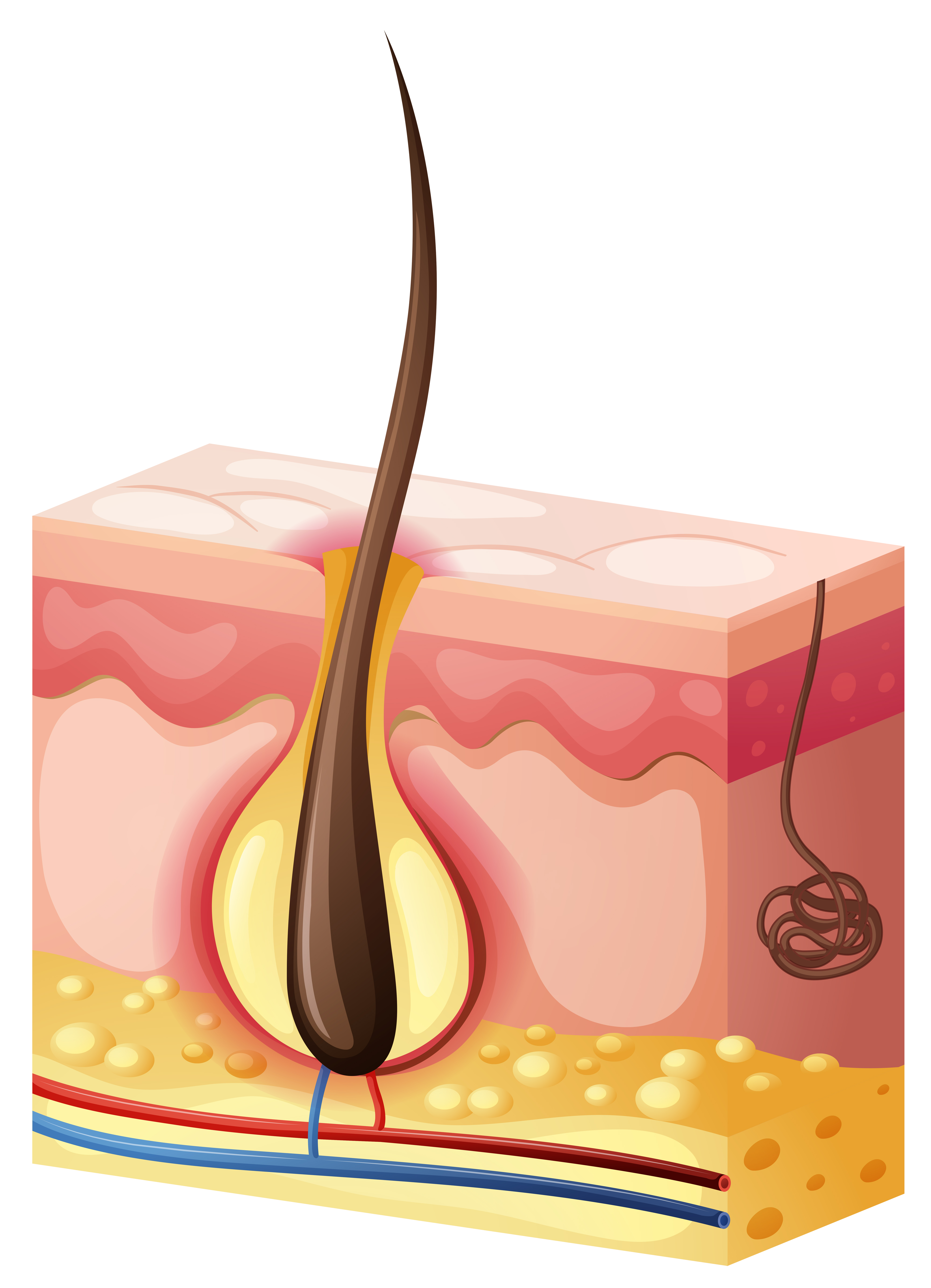 Hair growing from under skin 607629 Vector Art at Vecteezy Hair growing from under skin 607629 Vector Art at Vecteezy