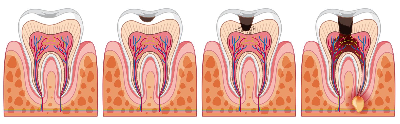 Un conjunto de diente humano vector