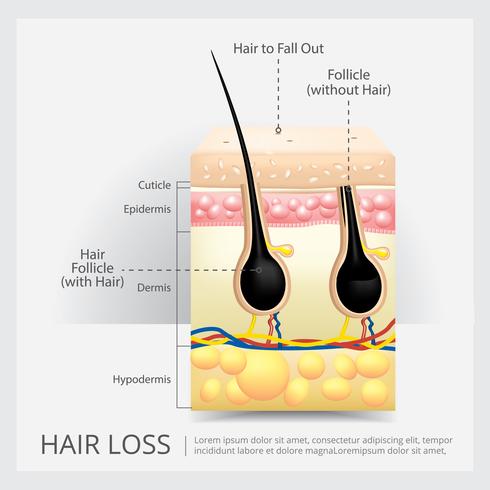 Estructura del pelo ennegrecida ilustración vectorial vector