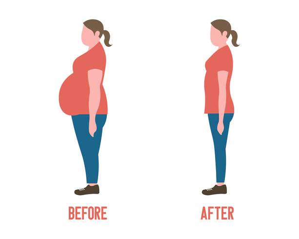 Forma del cuerpo de la mujer antes y después de la pérdida de peso vector