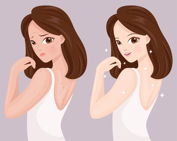 Broken skin and beautiful skin vector