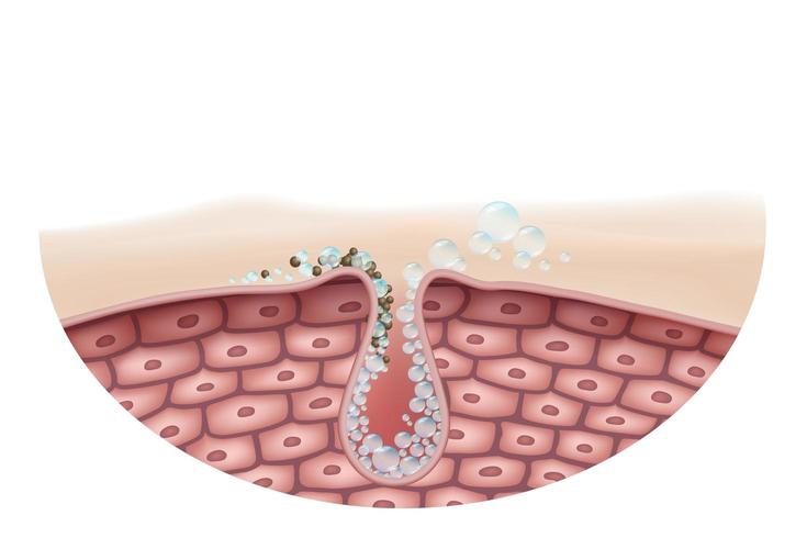 Close up cross section of skin cleansing  vector